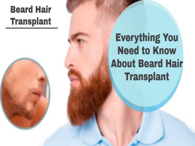 Everything You Need to Know About Beard Hair Transplant
