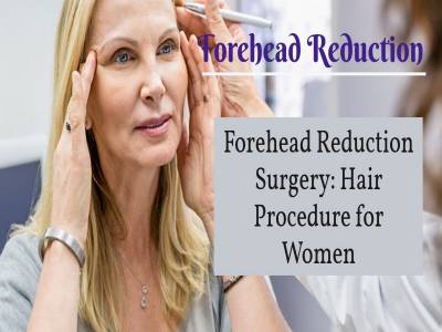 Forehead Reduction Surgery: Hair Procedure for Women