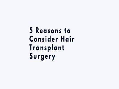 5 Reasons to Consider Hair Transplant Surgery
