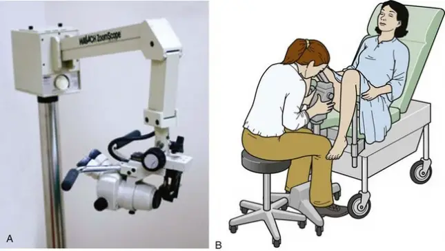 Colposcope (A) and method of examination (B). This technique is not a standard intervention by an emergency physician.