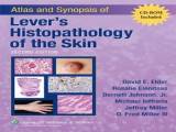 Atlas and Synopsis of Lever&#039;s Histopathology of the Skin