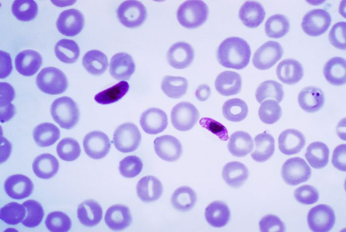 Blood smear of Plasmodium falciparum (gametocytes - sexual forms)