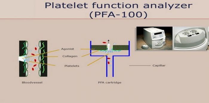 Platelet Function Analyzer (PFA-100)®