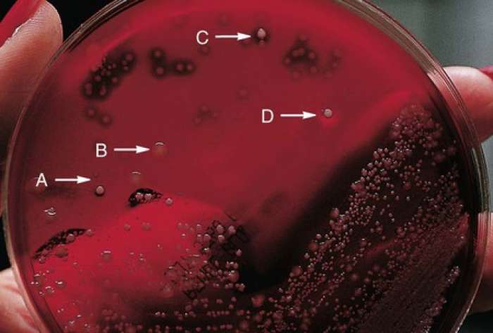 Different colony morphologies exhibited on sheep blood agar by various bacteria, including alpha-hemolytic streptococci (arrow A), gram-negative bacilli (arrow B), beta-hemolytic streptococci (arrow C), and Staphylococcus aureus (arrow D).