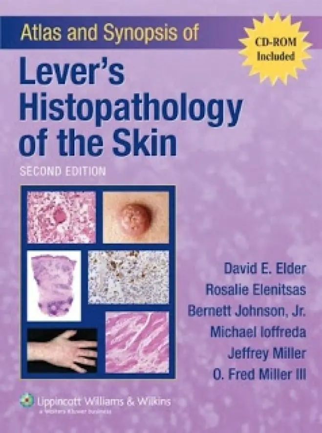 Atlas and Synopsis of Lever&#039;s Histopathology of the Skin 2nd Edition