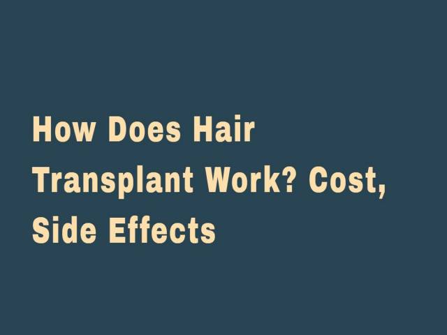 How does hair transplant work? Cost, side effects?