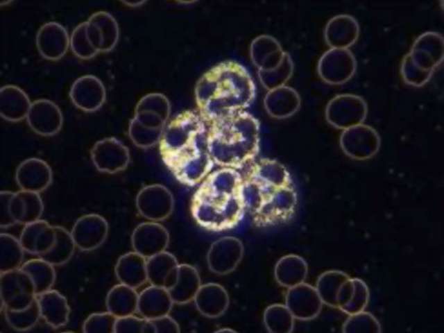 Red Blood Cells and Neutrophils Under Darkfield Microscope.