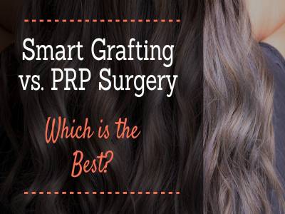 Smart Grafting vs. PRP Surgery: Which is the Best?