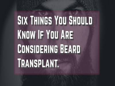 Six Things You Should Know If You Are Considering Beard Transplant