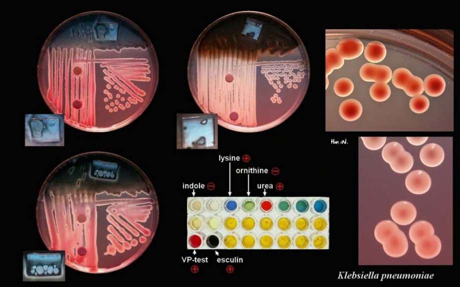 DIAGNOSTIC TESTS FOR IDENTIFICATION OF BACTERIA