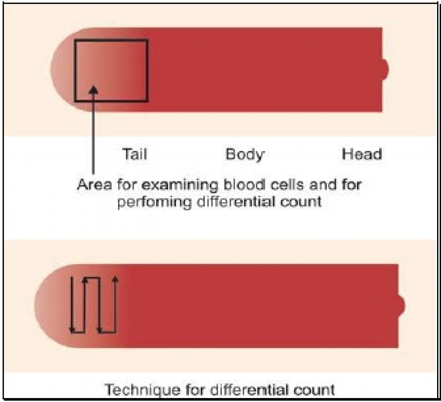 Area for examination of blood cells and for differential cell count in blood smear