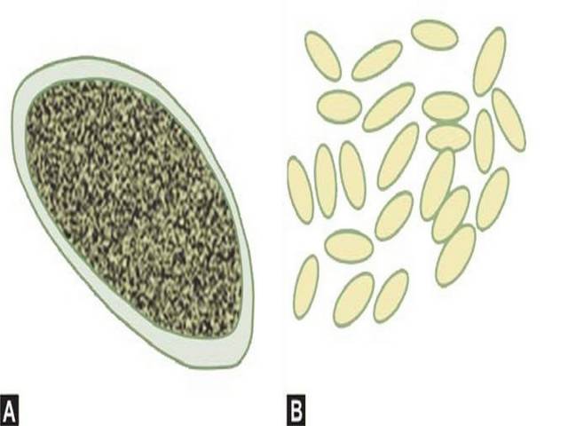 (A) Enterobius eggs, (B) Enterobius eggs collected by transparent tape method