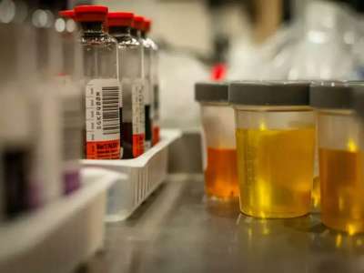 Urine samples in a biotechnology lab