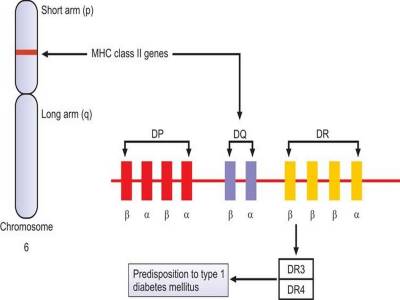 HLA-linked genetic predisposition to type 1 diabetes mellitus