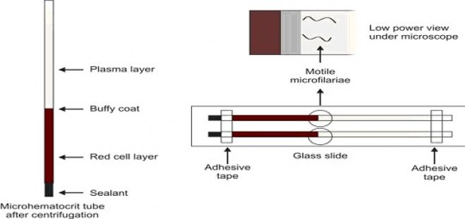 Microhematocrit tube concentration technique for demonstration of microfilaria