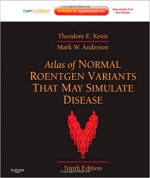 Atlas of Normal Roentgen Variants That May Simulate Disease: Expert Consult - Enhanced Online Features and Print, 9e