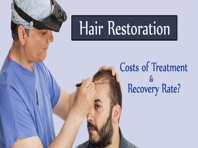 Hair Restoration: Costs of Treatment and Recovery Rate