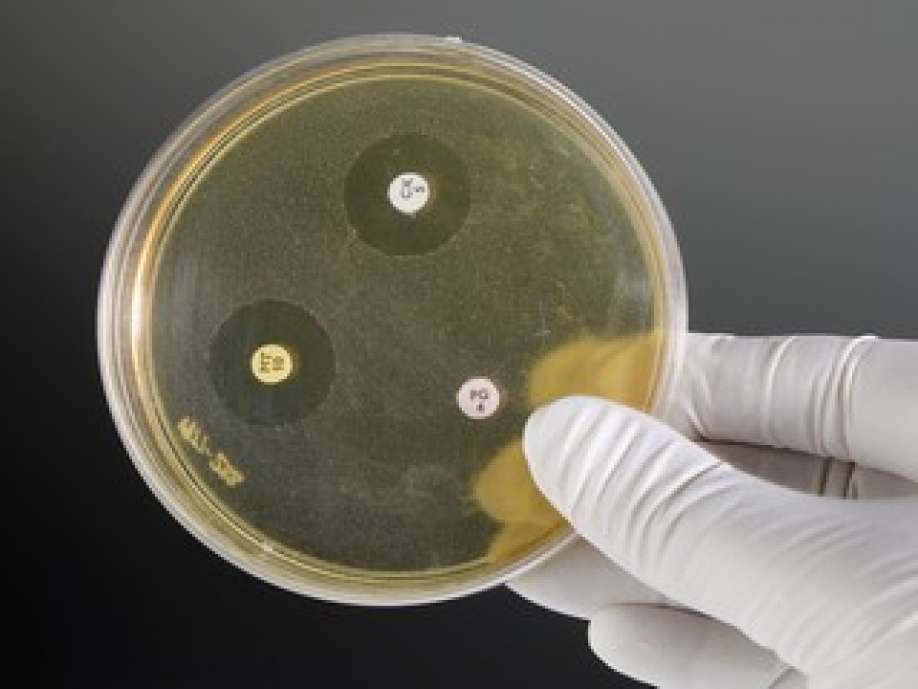Plastic model of an antibiotic sensitivity disc test