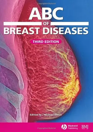   ABC of Breast Diseases (ABC Series)
