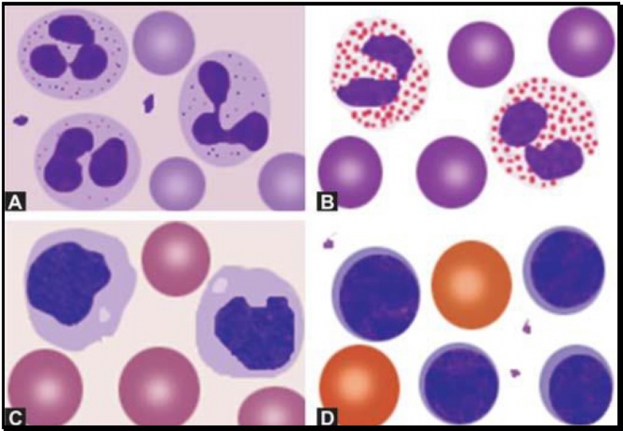 Figure 801.1 Numerical abnormalities of white blood cells: (A) Neutrophilia; (B) Eosinophilia; (C) Monocytosis; (D) Lymphocytosis