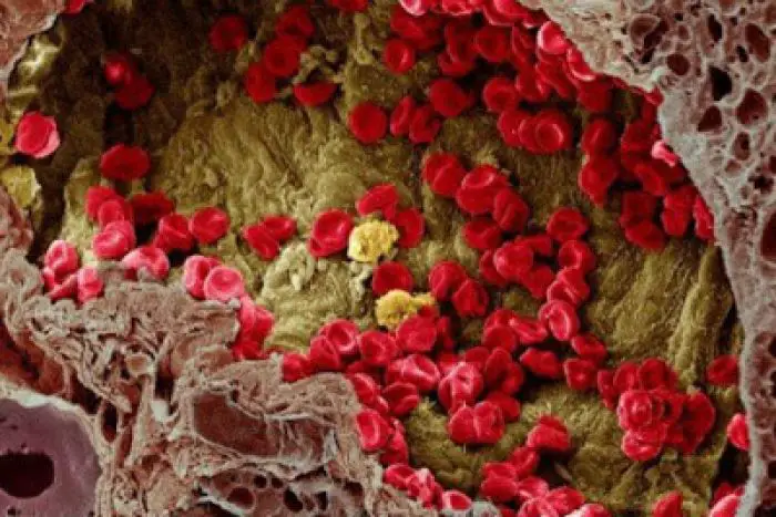 Scientists have finally figured out how cancer spreads through the bloodstream | Image: K. Hodivala-Dilke, M. Stone/Wellcome Images | Source: ScienceAlert