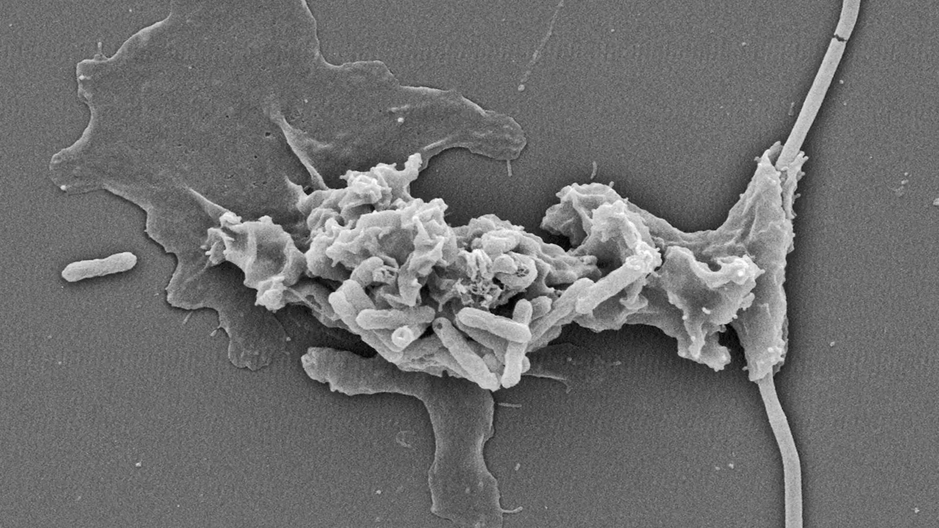 A microscopic view of the Incendiamoeba in black and white.