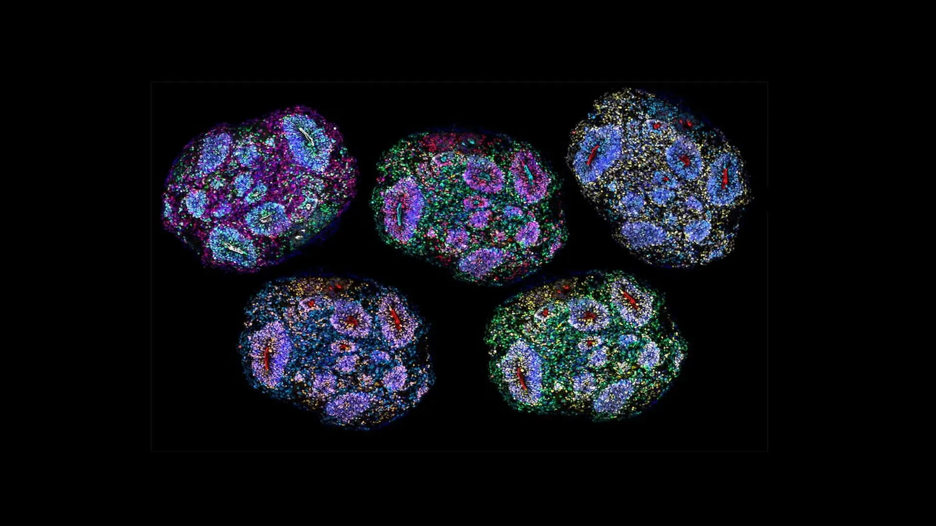 Brain Organoid Slices