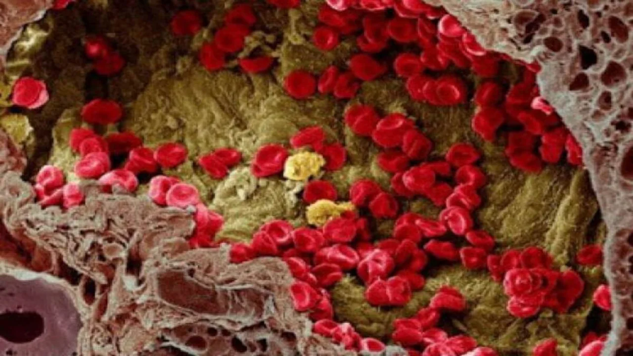 Scientists have finally figured out how cancer spreads through the bloodstream