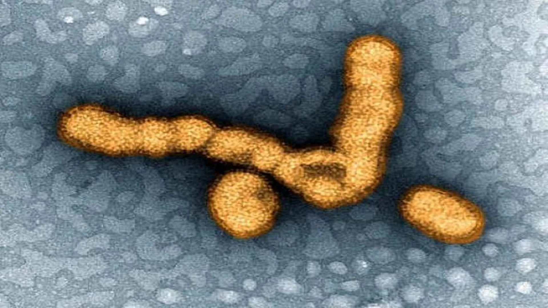 Credit: National Institute of Allergies and Infectious Diseases (NIAID)