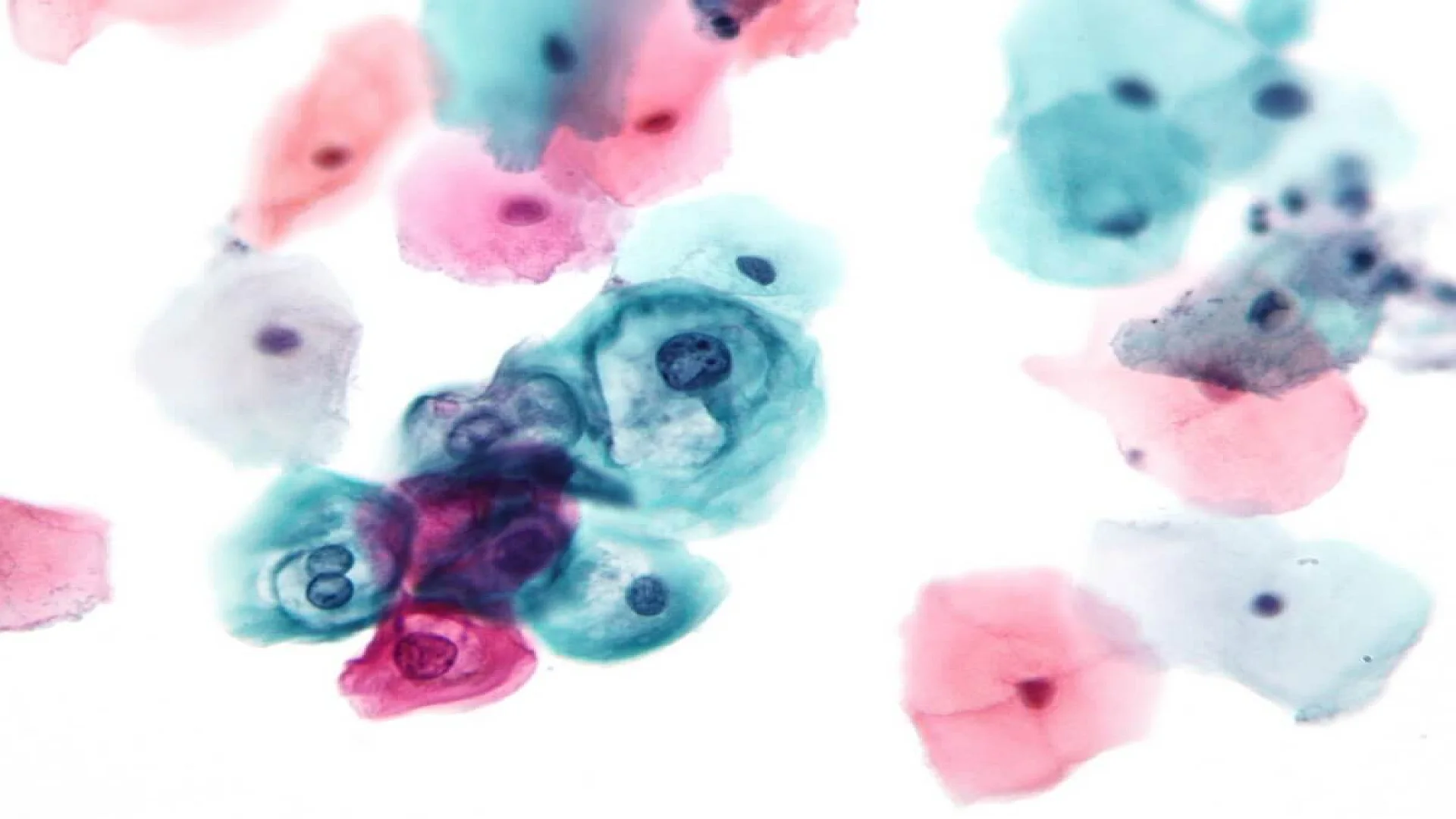 Papanicolaou Stain