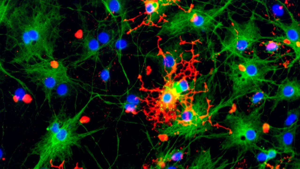 Prion-like damage triggers an immune response, causing astrocytes to form scars.