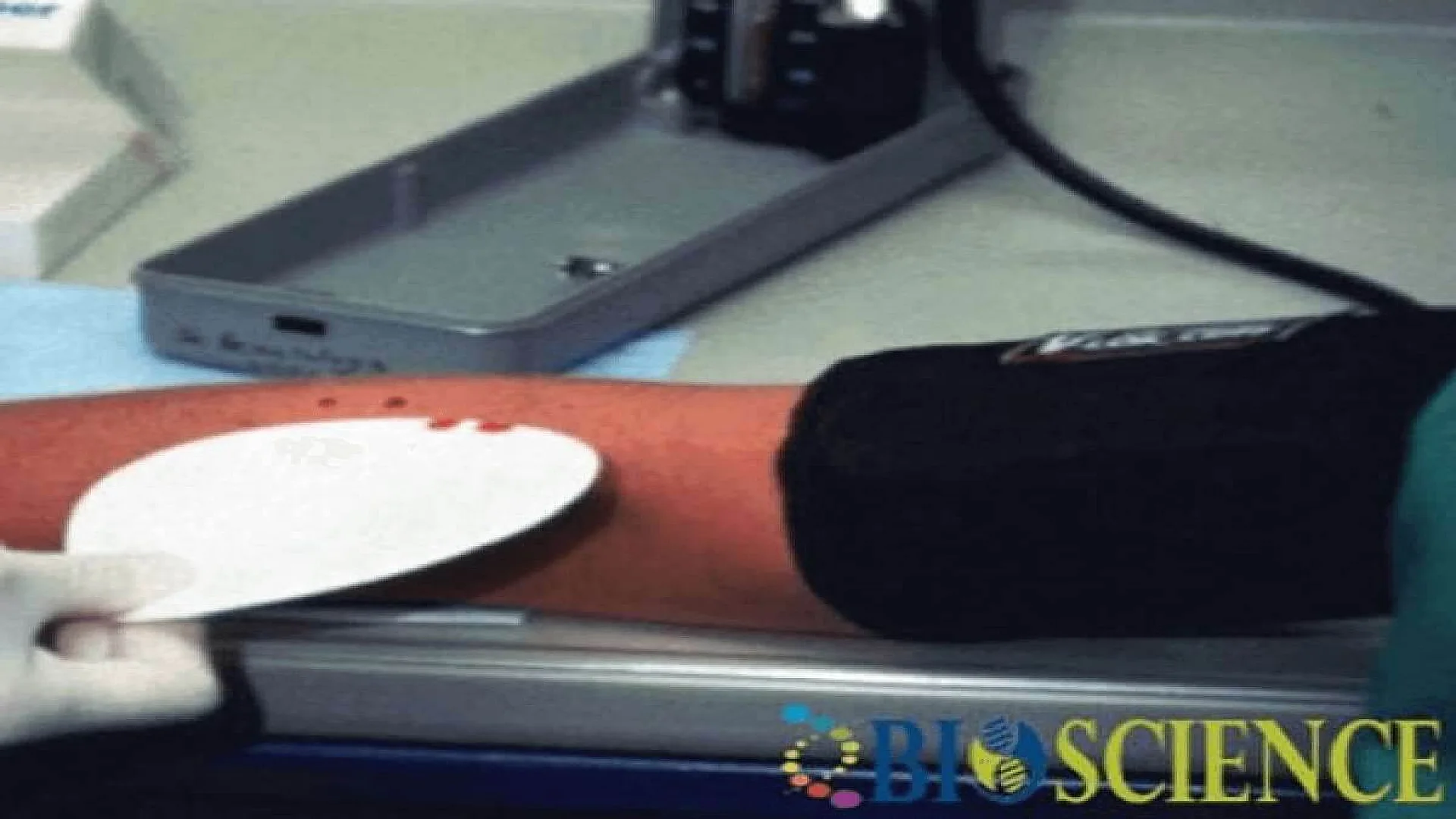 Bleeding Time (BT) and Clotting Time (CT)