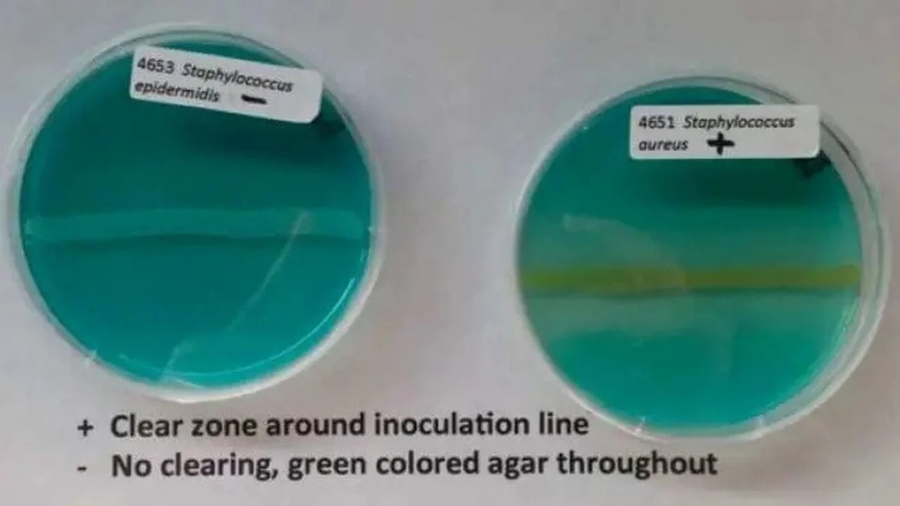 DNase Test.