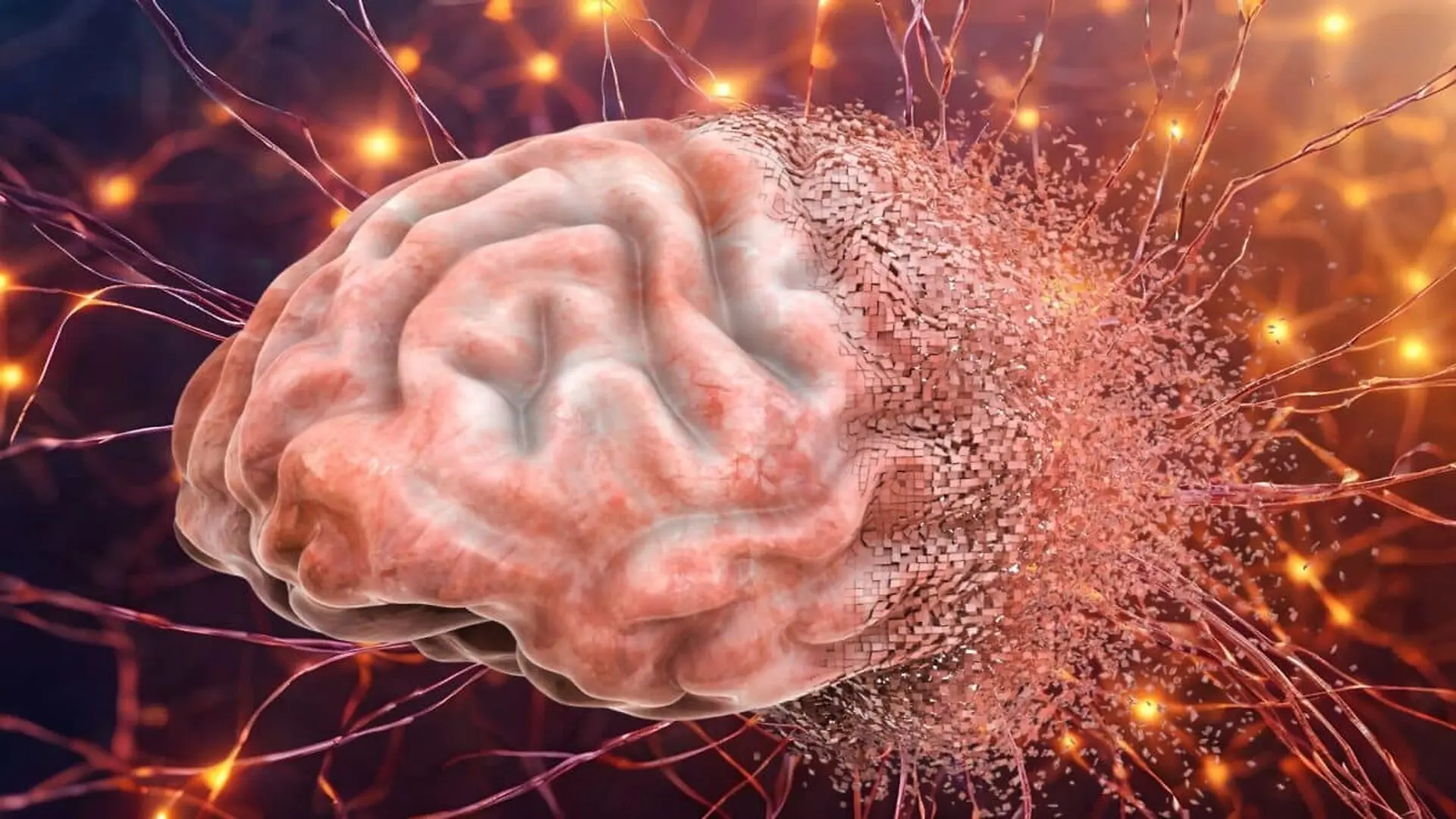 Concept Of Brain Disease Or Destruction Memory Loss Scaled