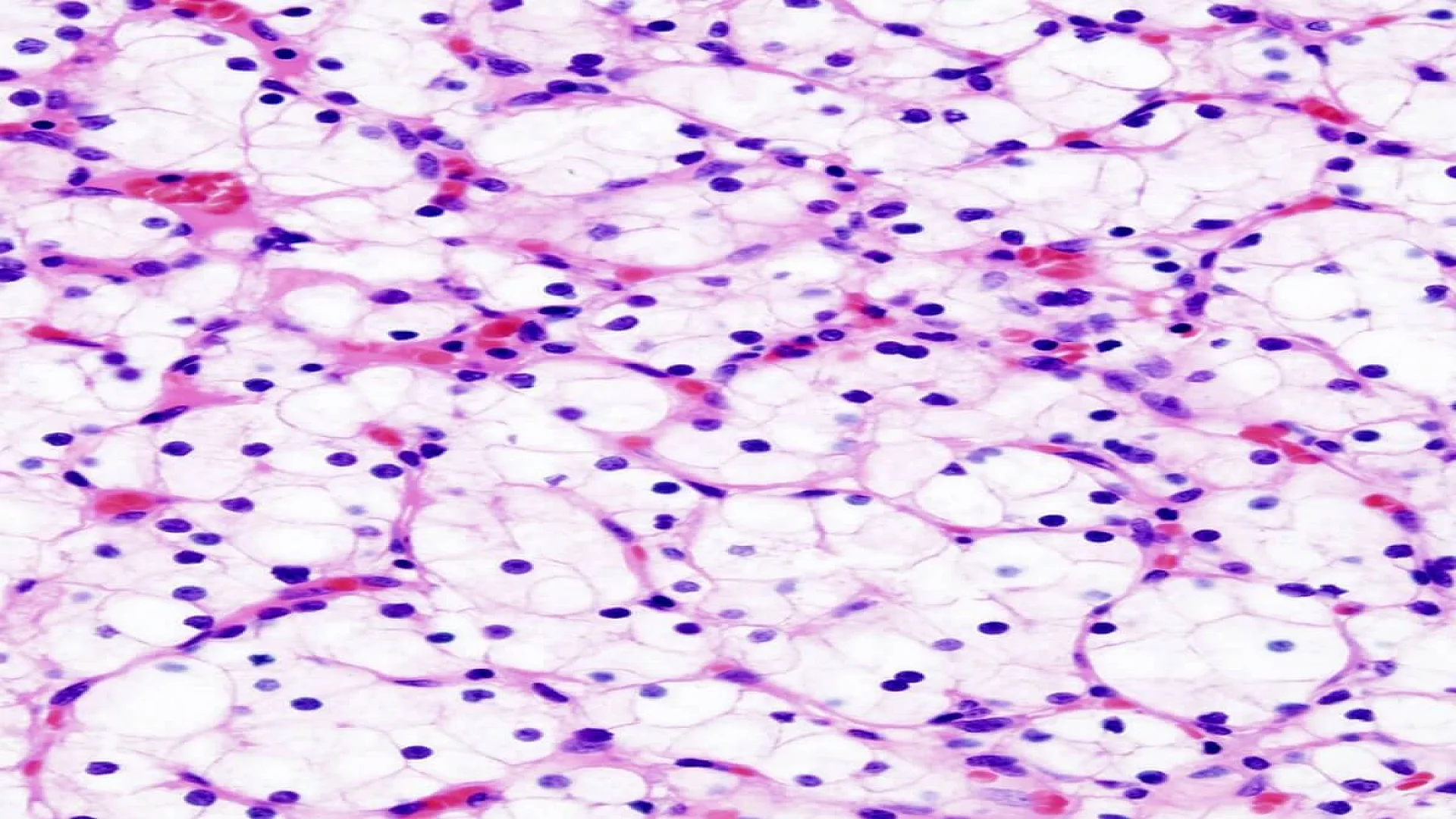 Hematoxylin and Eosin Staining