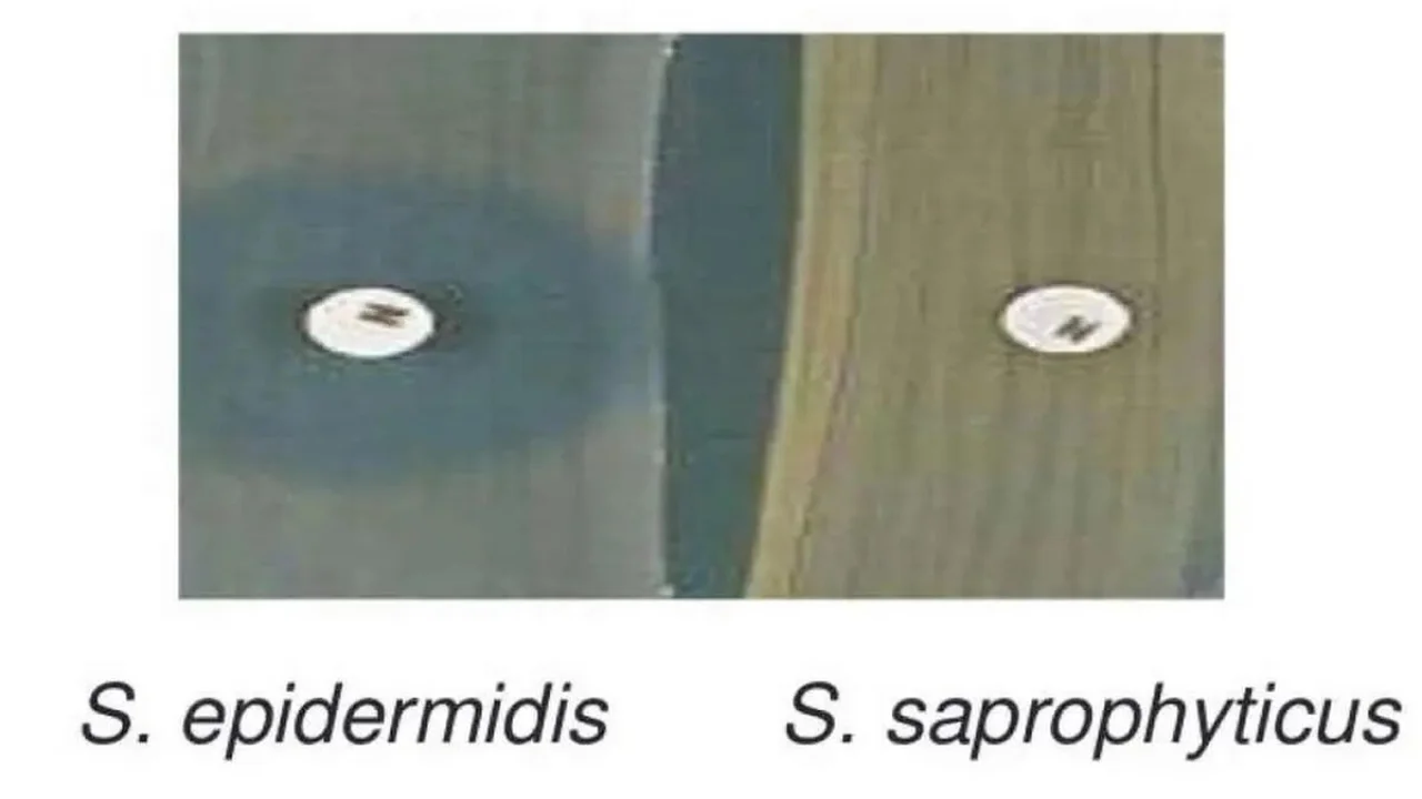 NOVOBIOCIN DISC TEST