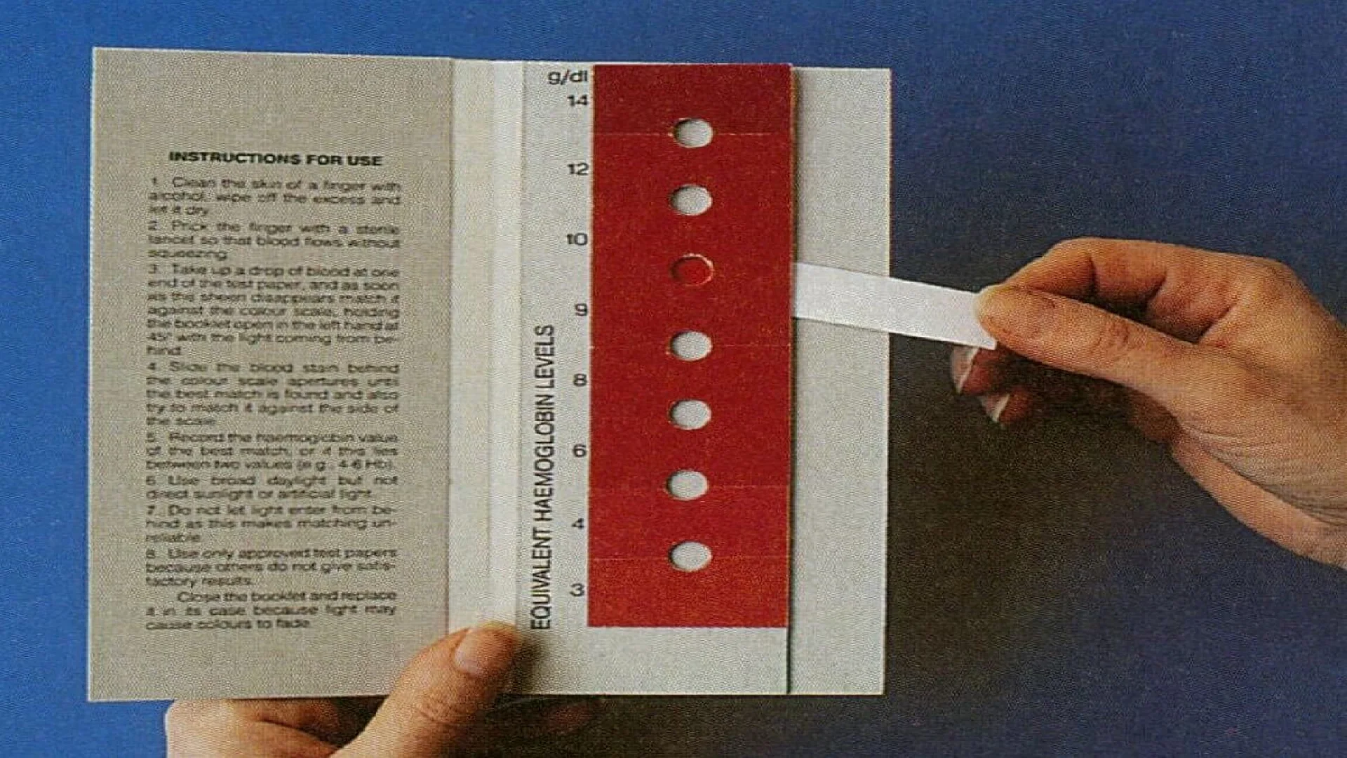 WHO Hemoglobin Color Scale. Bulletin of the World Health Organization, 1995, 73 (3): 369-373.