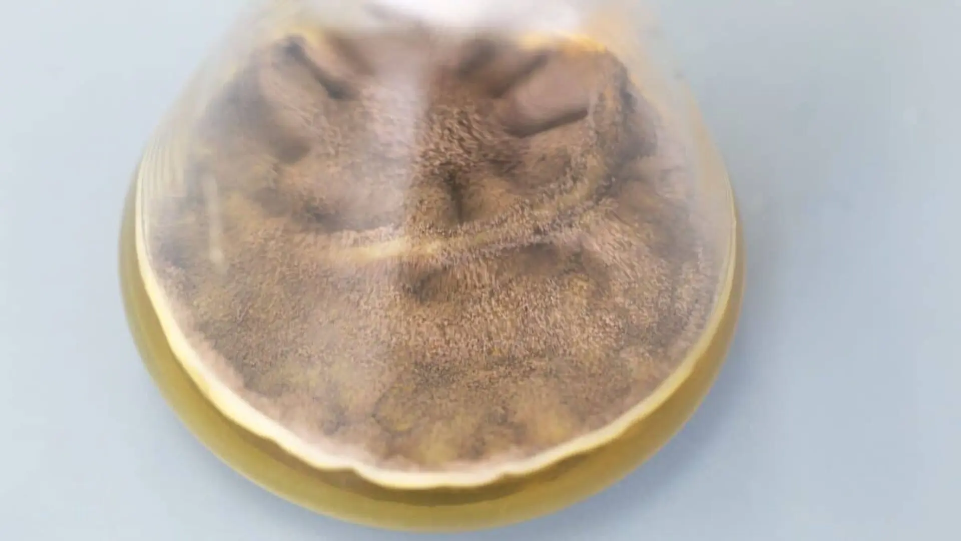 This Gut Fungus May Help Protect The Body From Radiation Damage Scaled