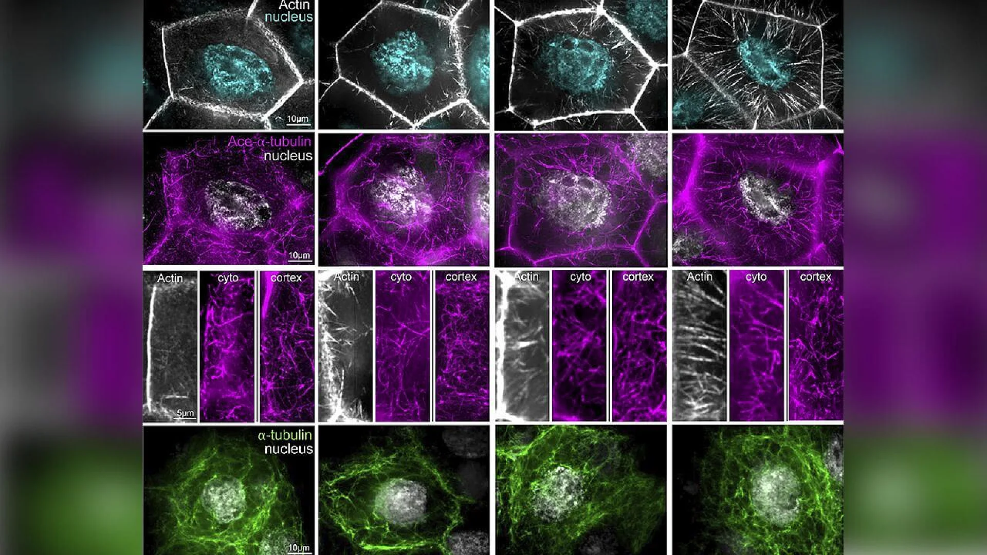 Microscopic grid showing four stages of fruit fly nurse cell development. The rows display gray actin cables growing toward a cyan nucleus, magenta stabilized microtubules, and a dense green network of total microtubules.