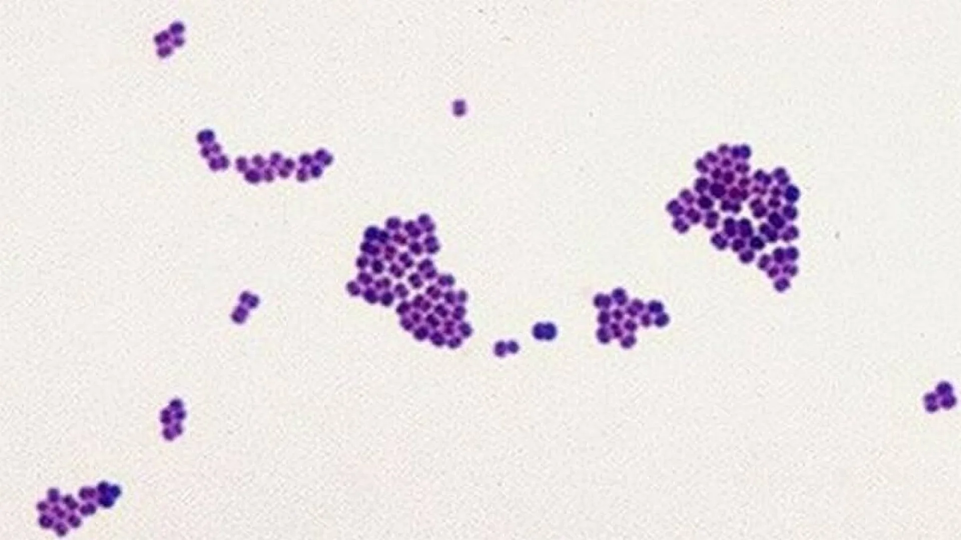 Clusters of Gram-positive bacteria.