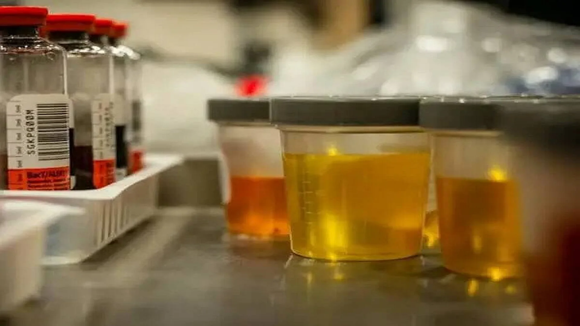 Urine samples in a biotechnology lab.