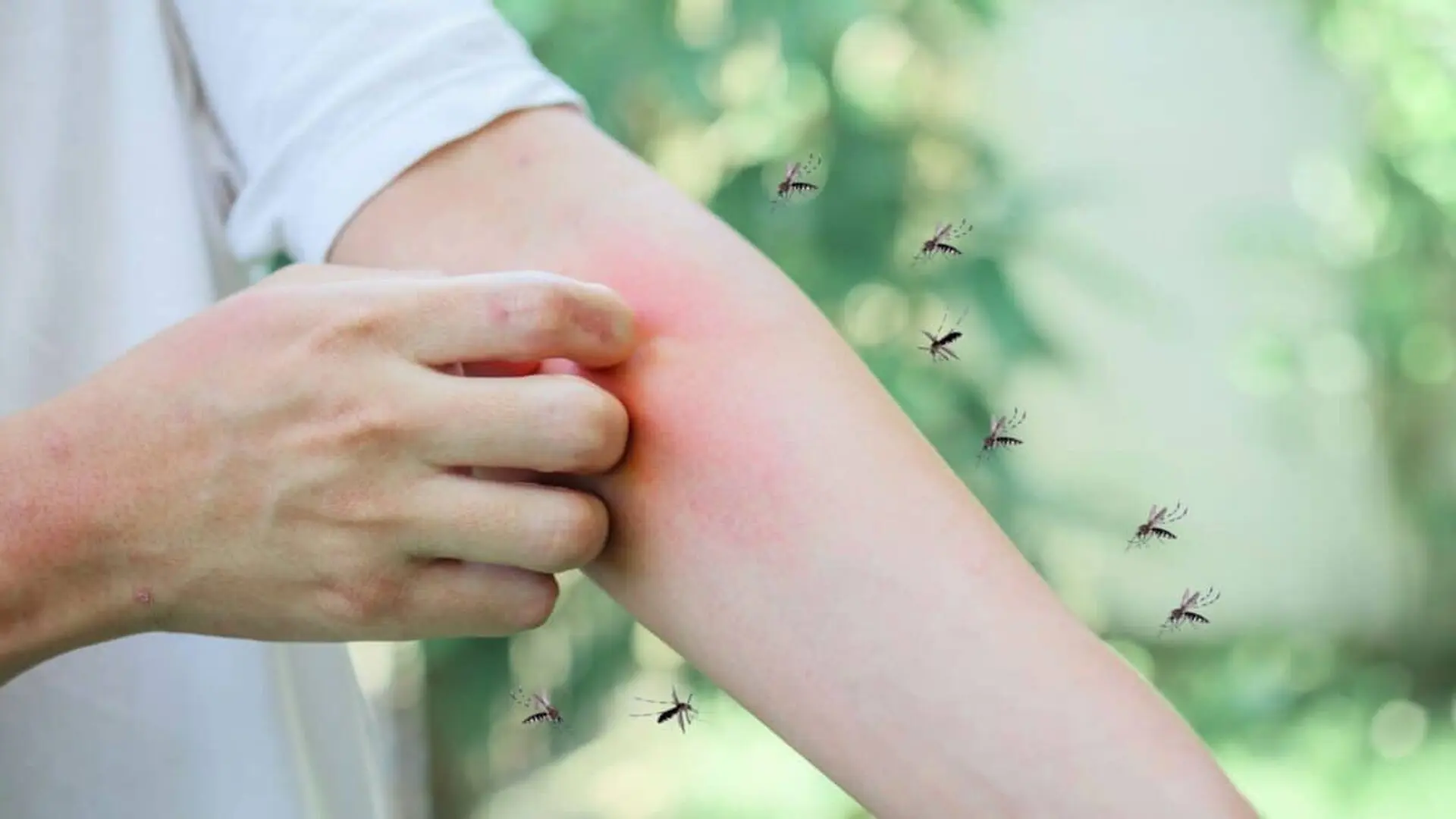 Why Do Mosquitoes Always Find You Study Reveals What Makes Some People More Attractive Scaled