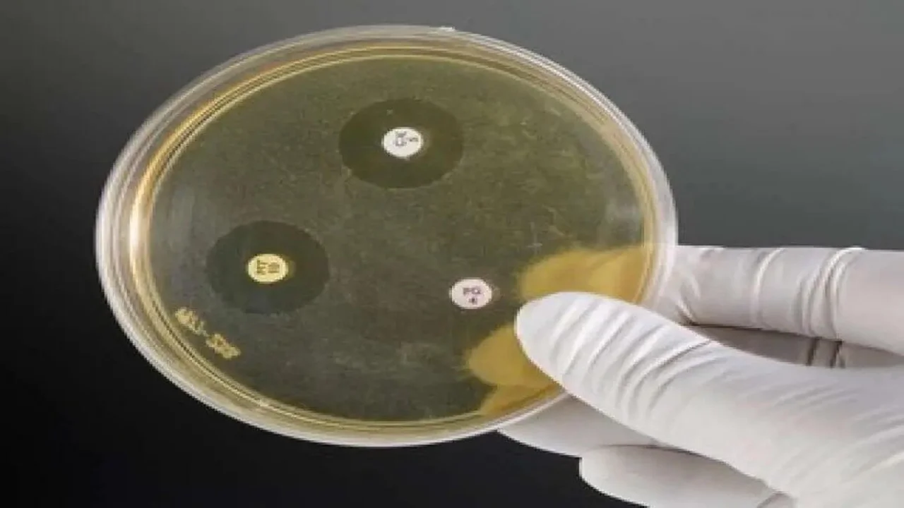 Plastic model of an antibiotic sensitivity disc test.