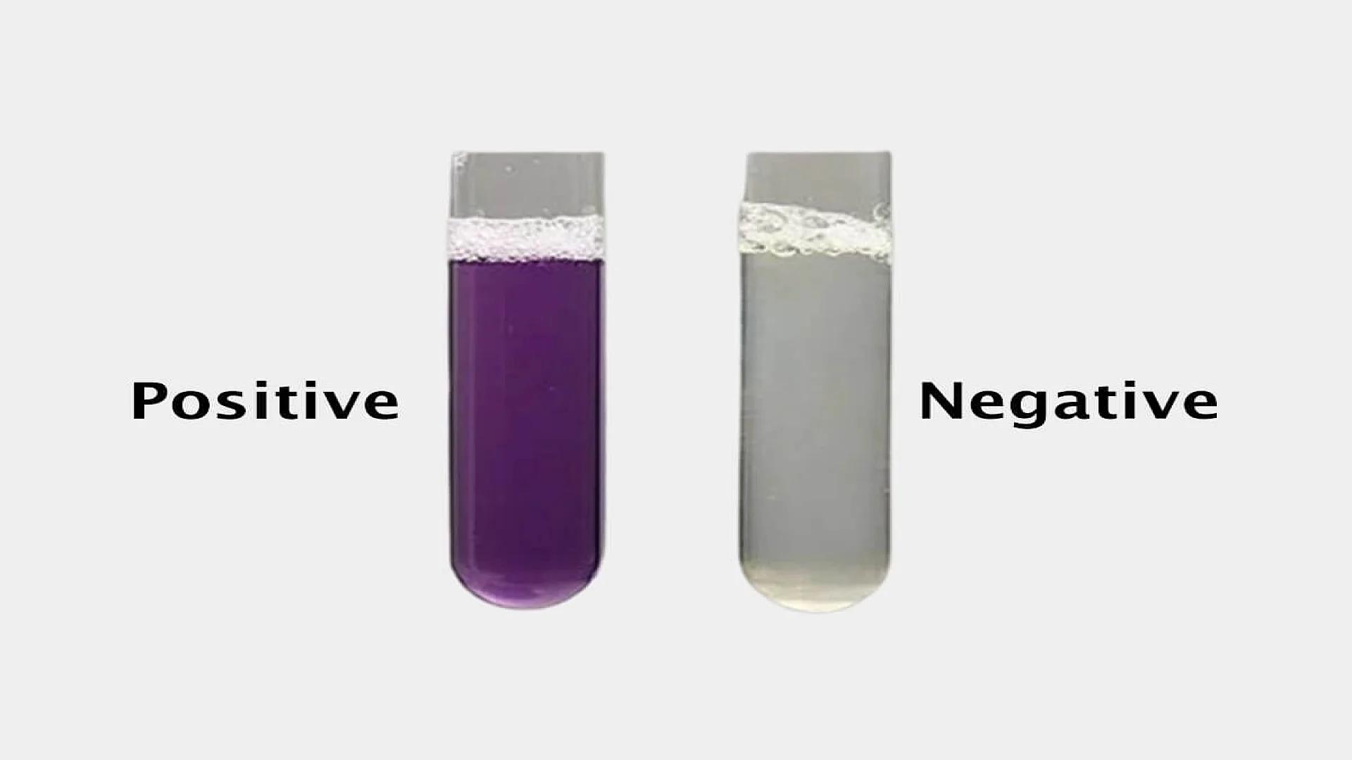 Biuret Test Reaction