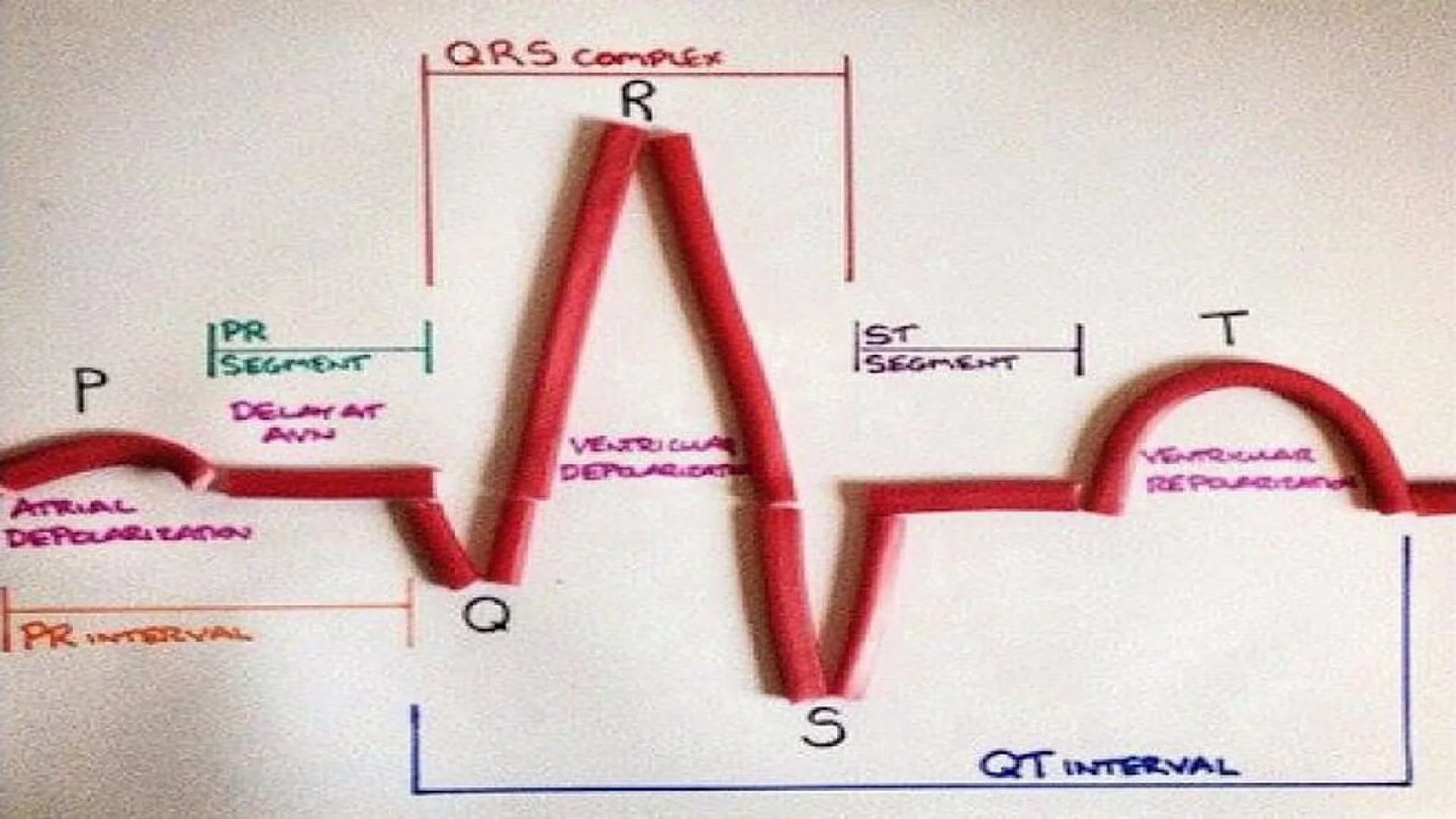 ECG PQRST Wave