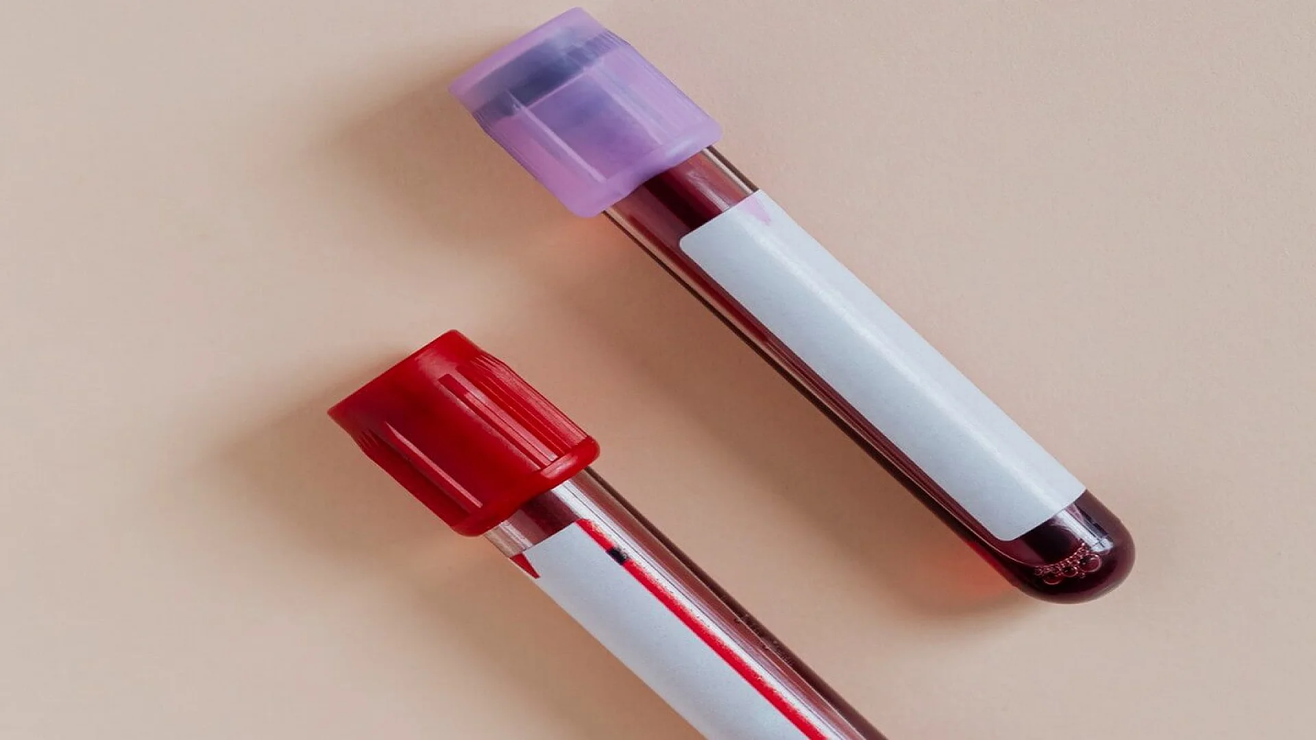 Blood Test Tubes on a Beige