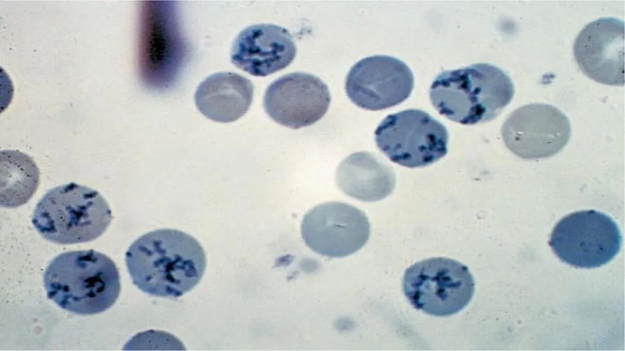 Reticulocytes