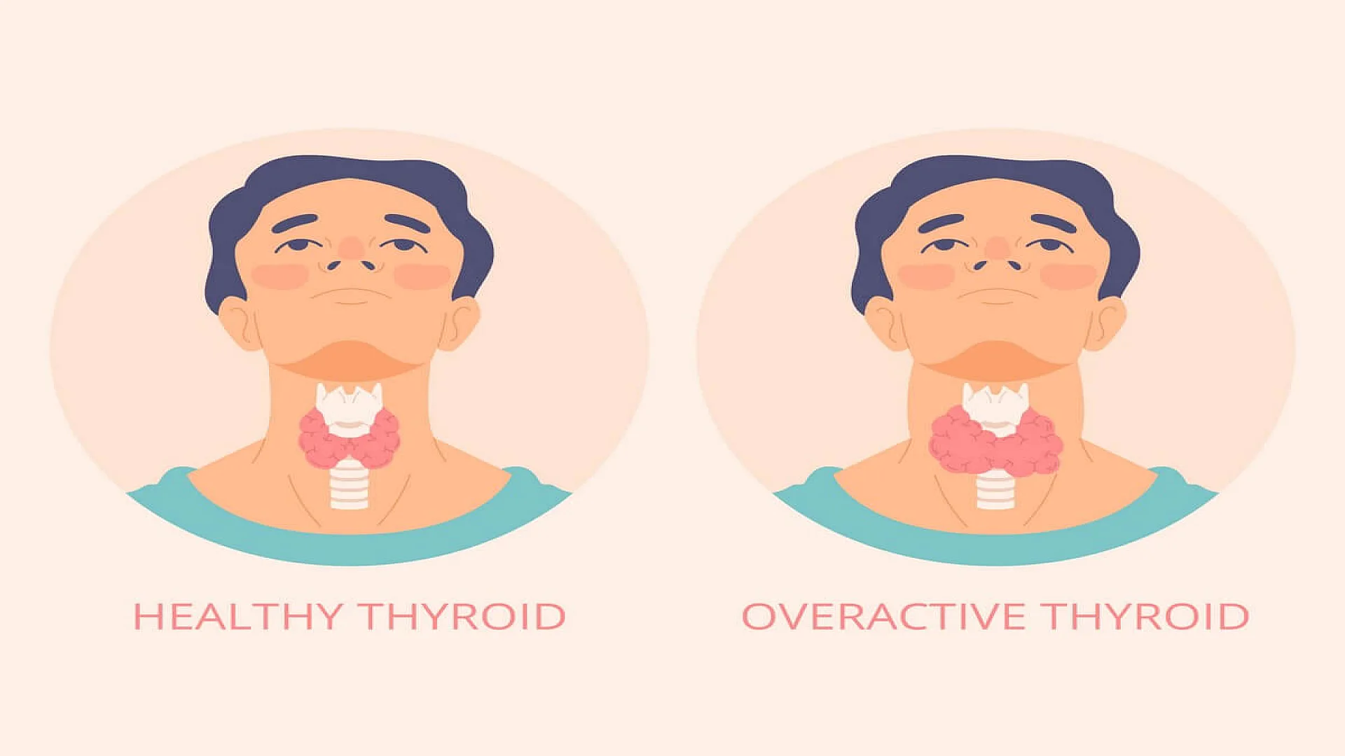 Hand drawn flat design thyroid illustration.
