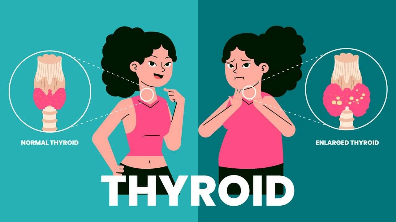 Hand drawn flat design thyroid illustration.