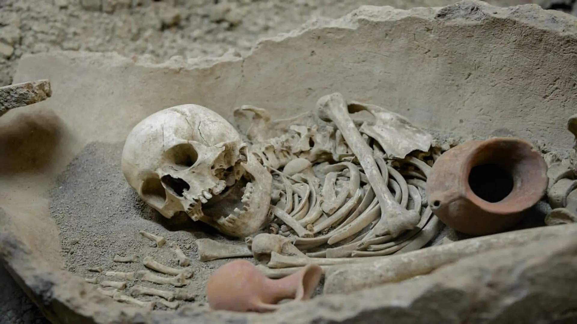 These Ancient Skeletons Were Expected To Reveal Syphilis But Scientists Found A Different Disease Story Scaled
